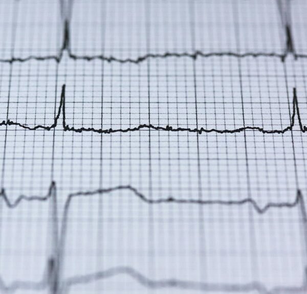 Apex Rise 912777442 Strategic Pulse