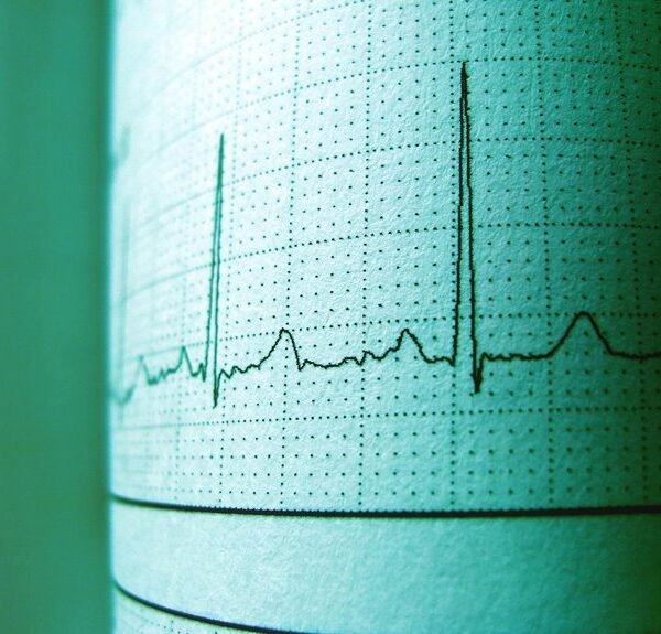 Nova Pulse 914842500 Opportunity Track