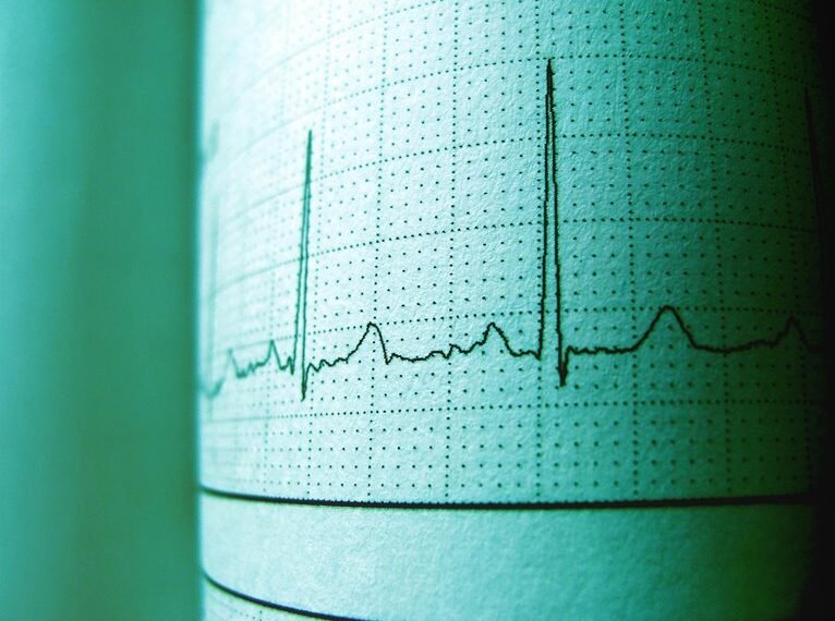 nova pulse 914842500 opportunity track